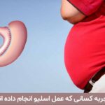 تجربه کسانی که عمل اسلیو انجام داده اند