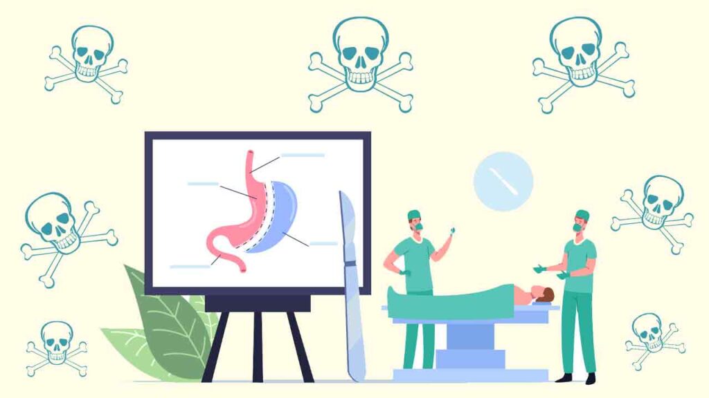 آیا احتمال مرگ در اثر جراحی لاغری وجود دارد؟