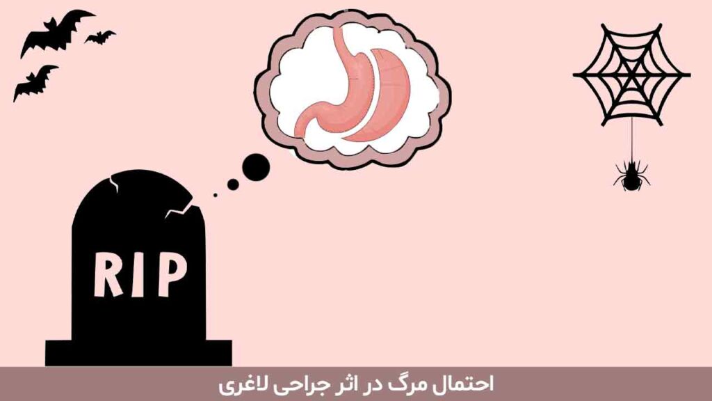 احتمال مرگ در اثر جراحی لاغری