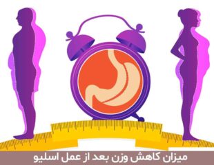 میزان کاهش وزن بعد از عمل اسلیو