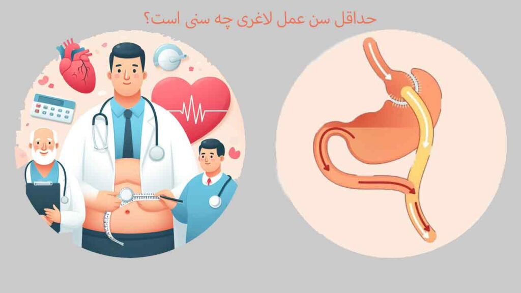کمترین سن برای عمل لاغر ی