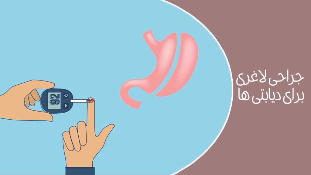 جراحی لاغری برای دیابتی ها