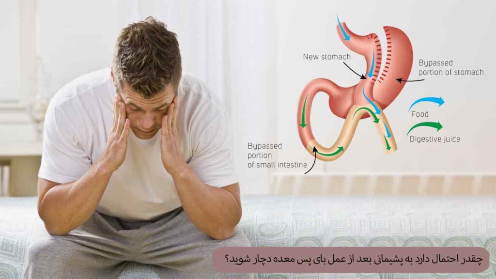 چقدر احتمال دارد به پشیمانی بعد از عمل بای پس معده دچار شوید؟