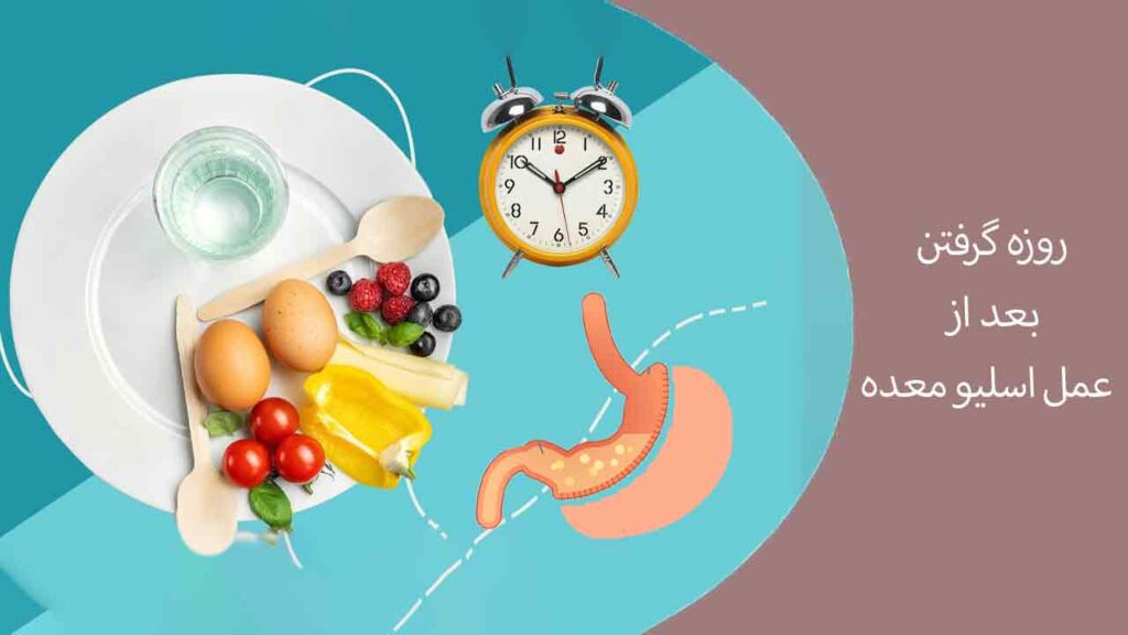 روزه گرفتن بعد از عمل اسلیو معده